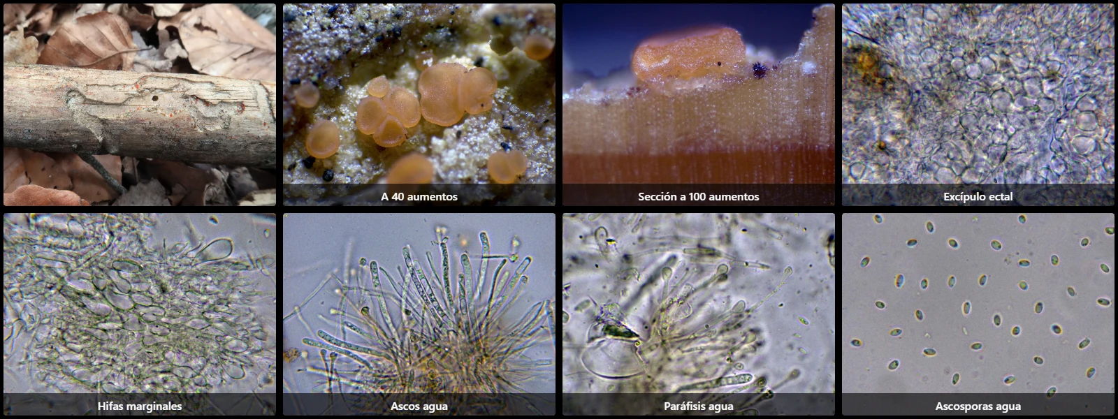 Microscopía de Orbilia eucalypti
