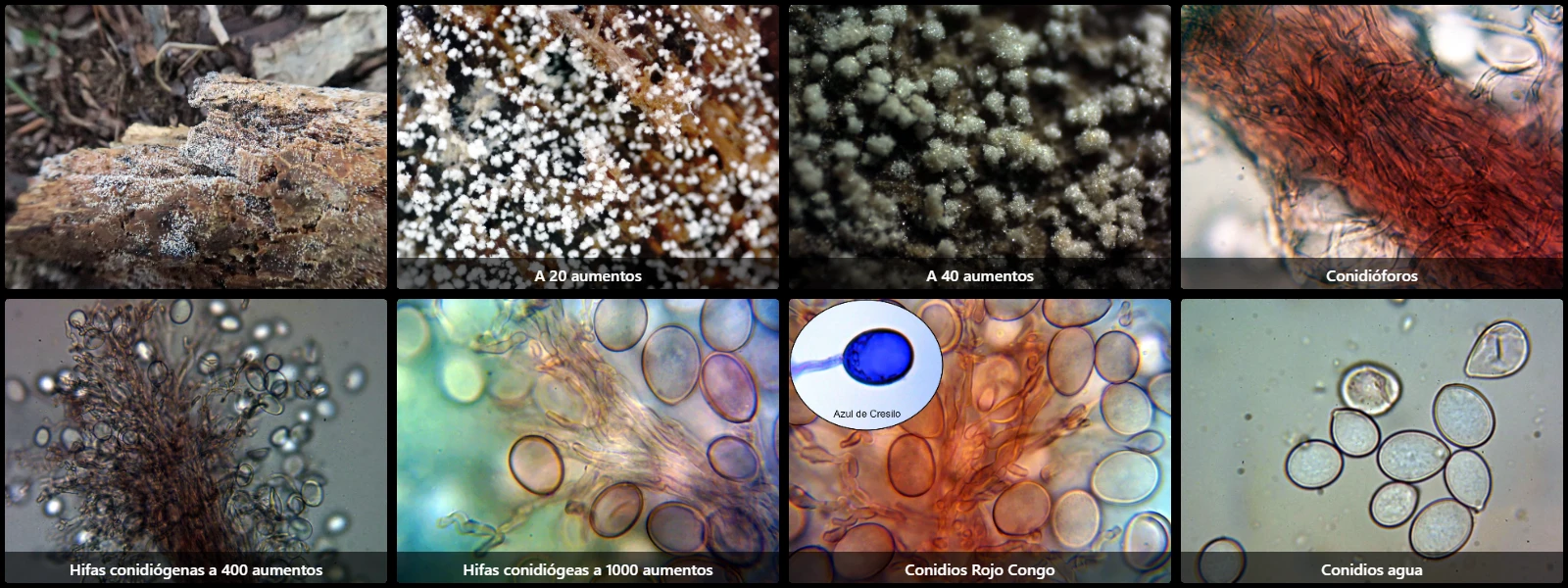 Microscopía de Pachnocybe albida