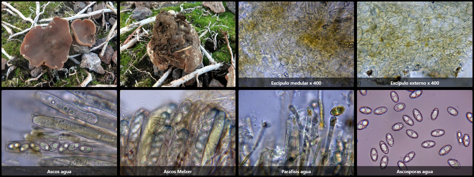 Microscopía de Paragalactinia michelii