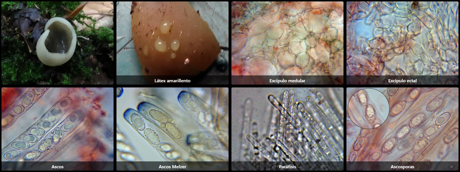 Microscopía de Paragalactinia succosa