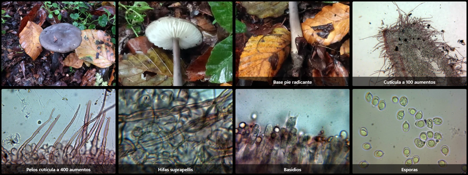 Microscopía de Paraxerula caussei