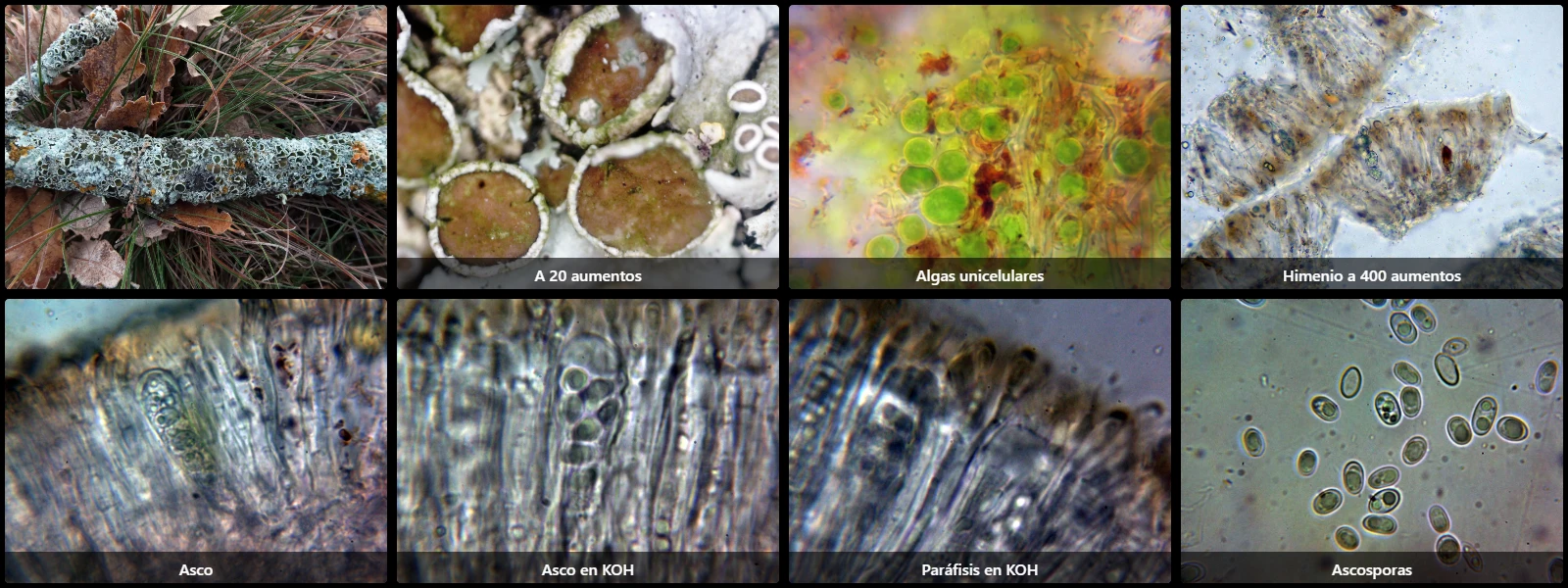 Microscopía de Parmelina quercina