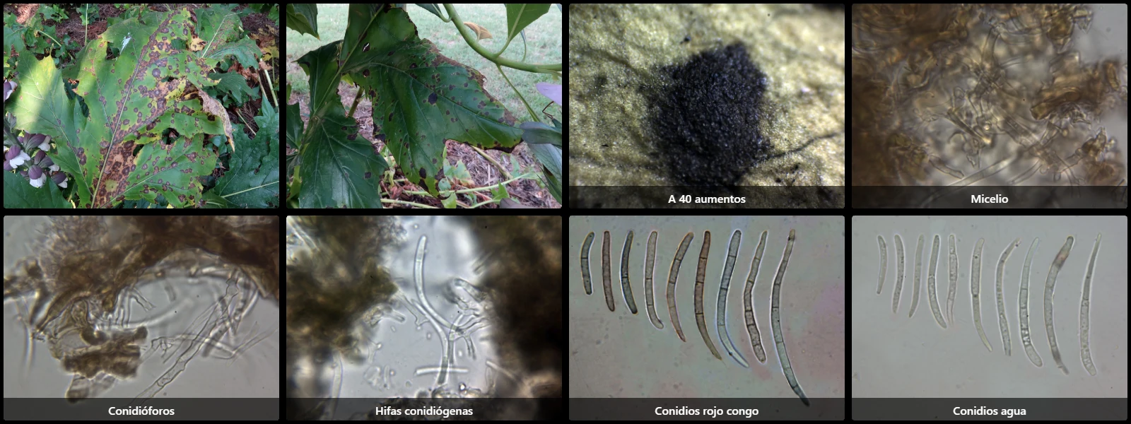 Microscopía de Passalora acanthicola