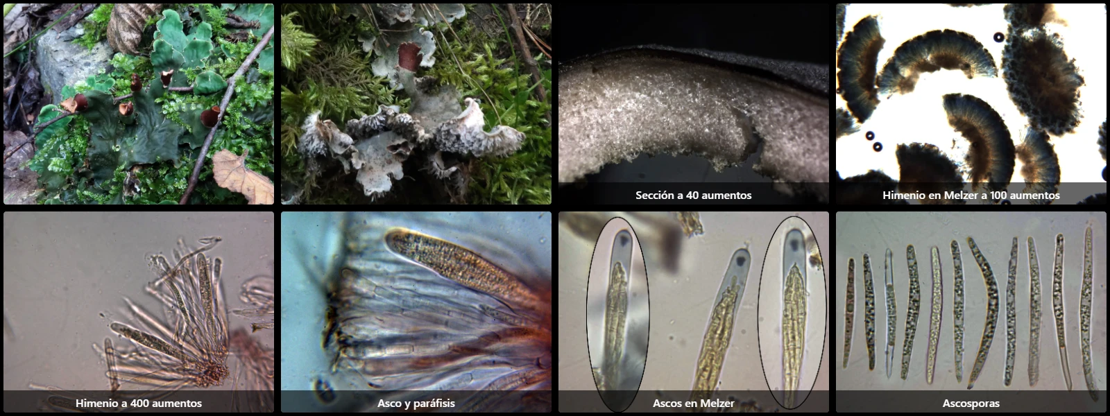 Microscopía de Peltigera polydactylon