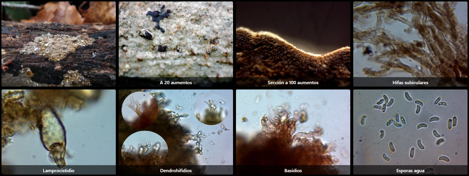 Microscopía de Peniophora versiformis
