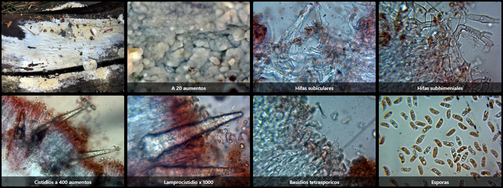 Microscopía de Peniophorella pubera