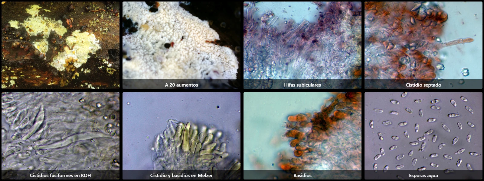 Microscopía de Peniophorella rude