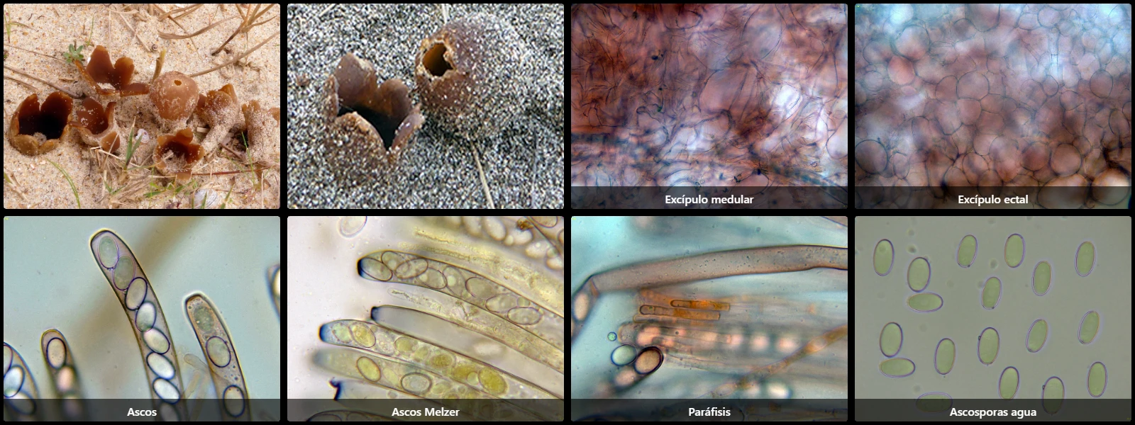 Microscopía de Peziza ammophila