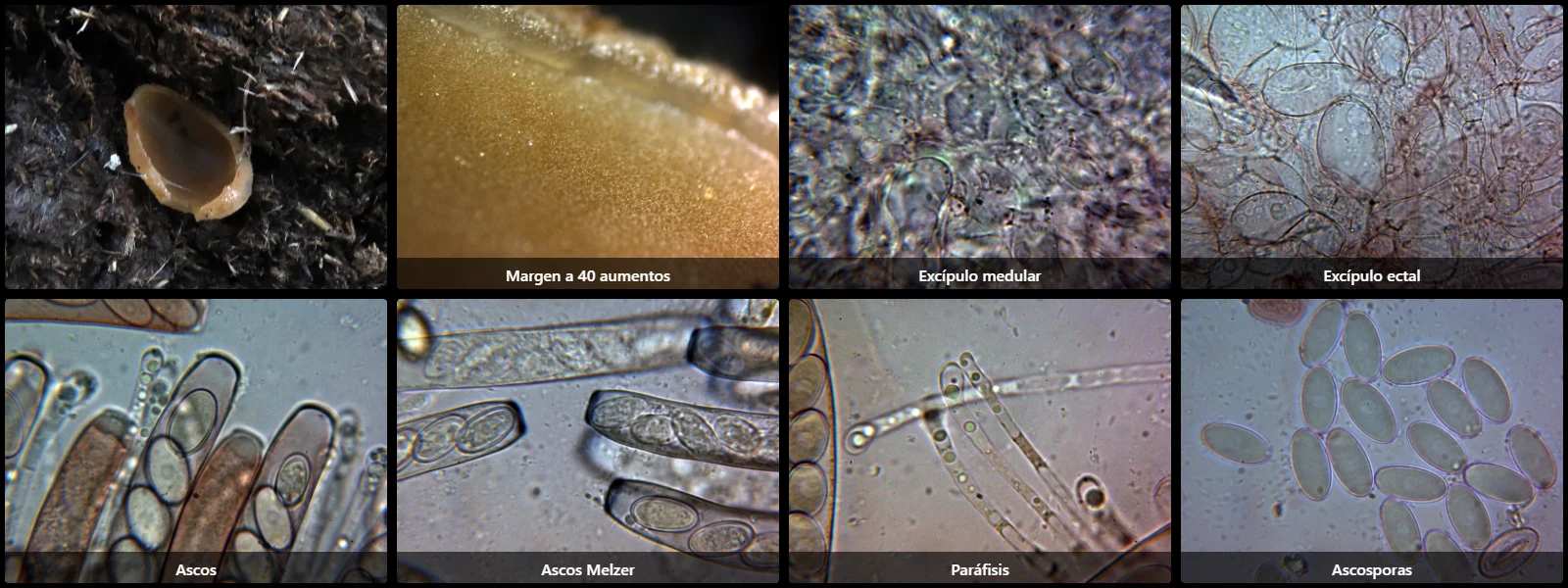 Microscopía de Peziza fimeti