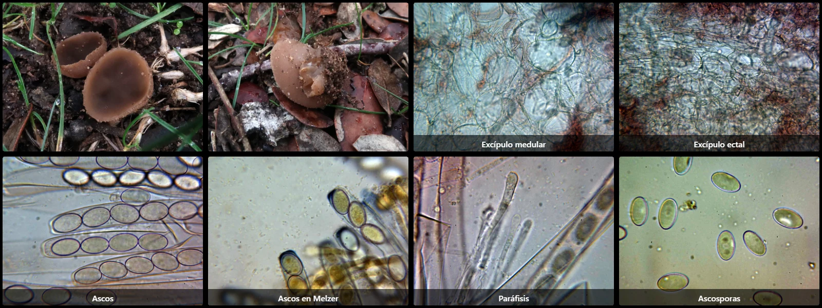 Microscopía de Peziza repanda