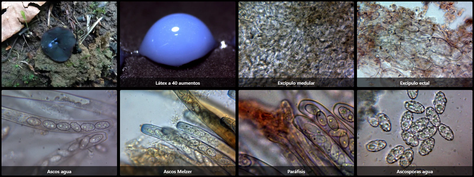Microscopía de Peziza saniosa