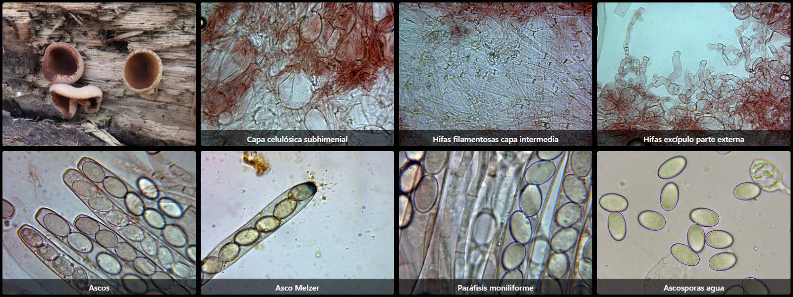 Microscopía de Peziza varia