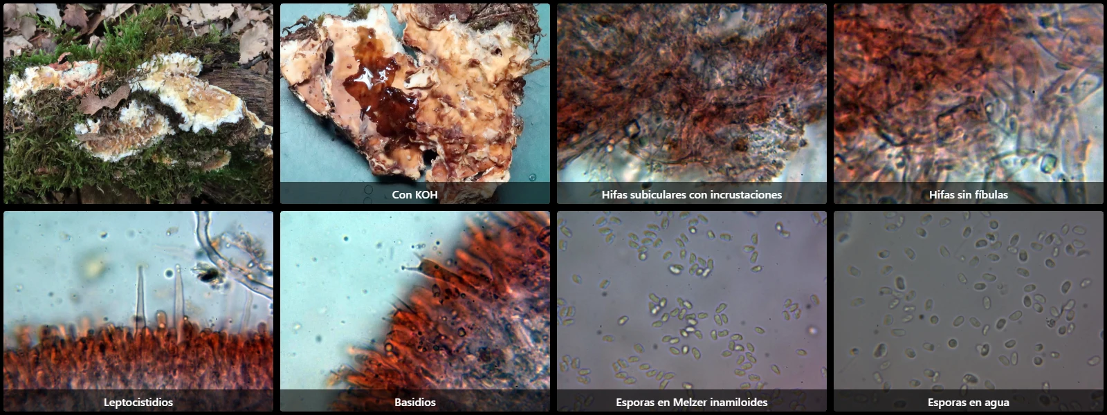Microscopía de Phanerochaete calotricha
