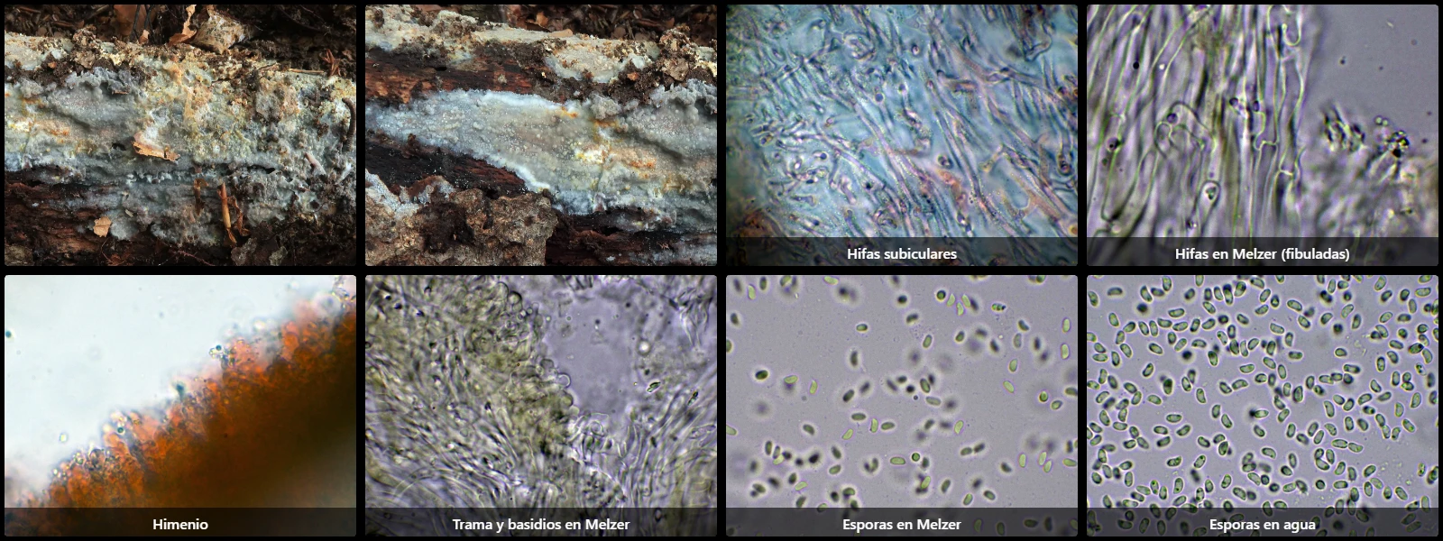 Microscopía de Phlebia lilascens