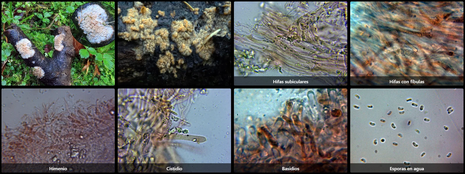 Microscopía de Phlebia radiata