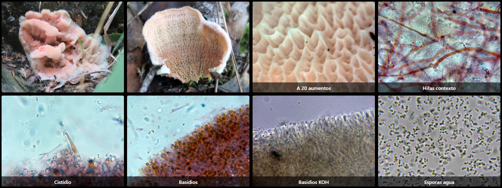 Microscopía de Phlebia tremellosa