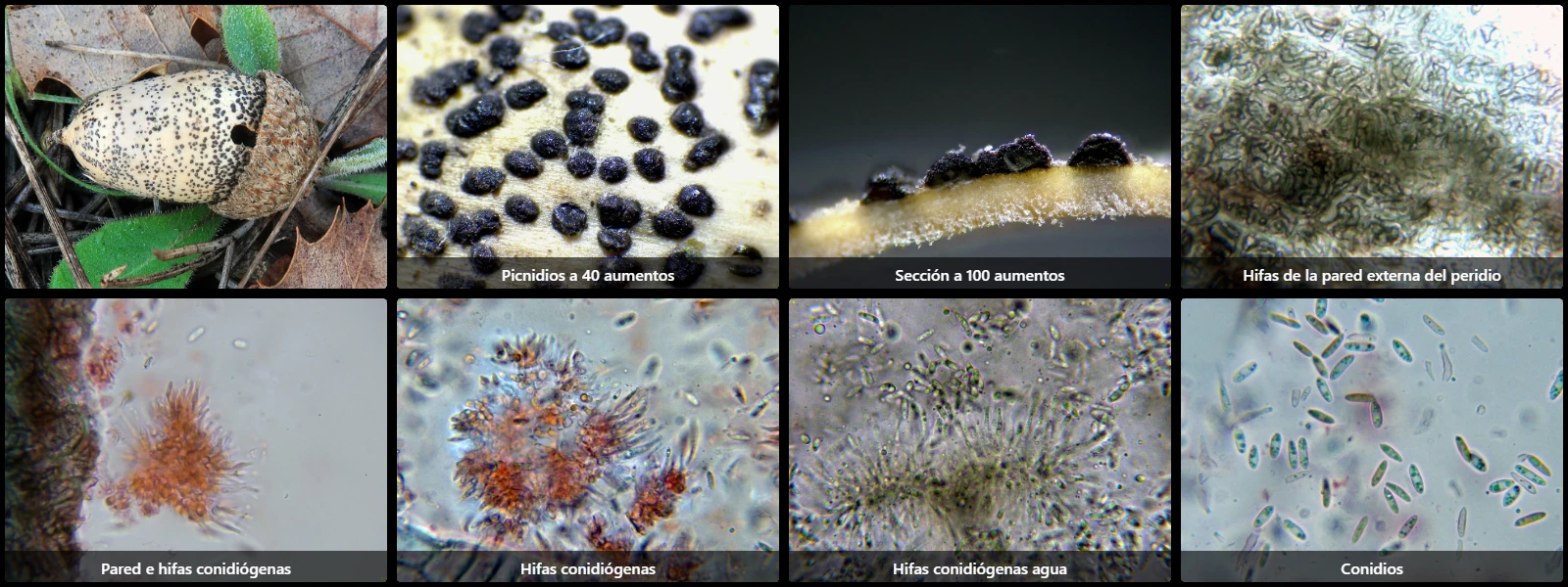 Microscopía de Phomopsis glandicola
