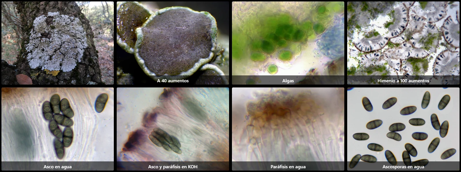 Microscopía de Physcia aipolia