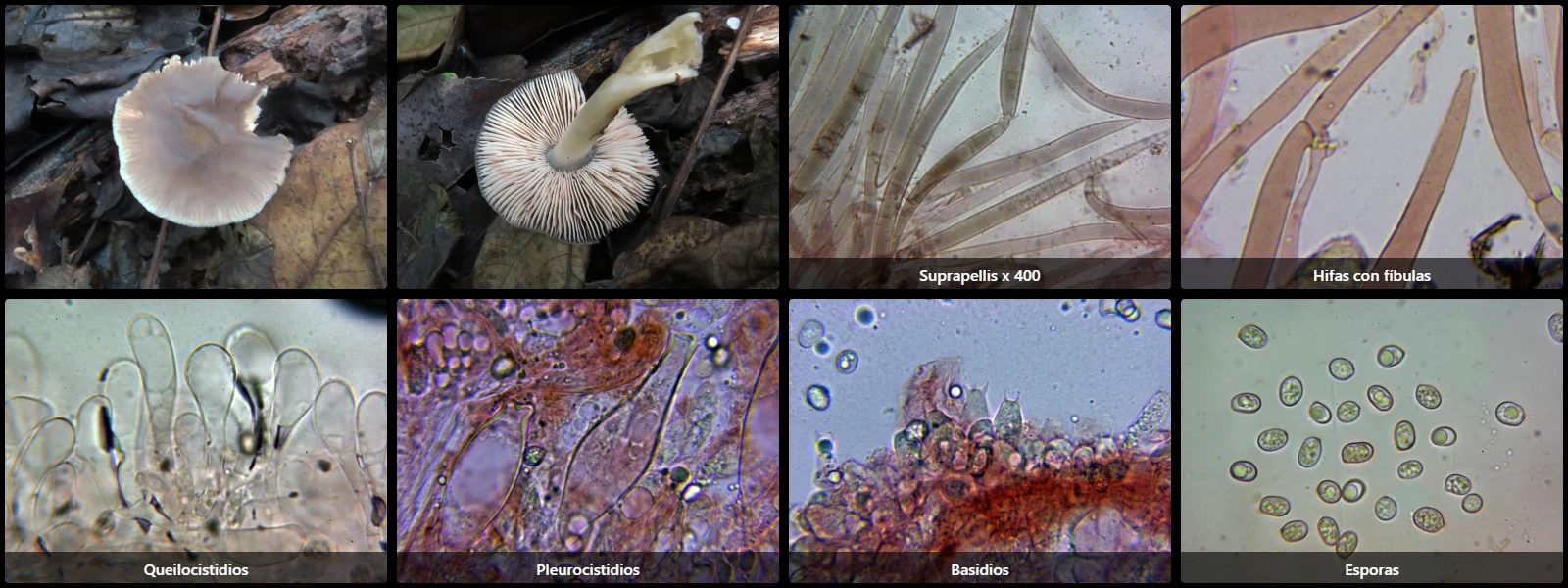 Microscopía de Pluteus salicinus