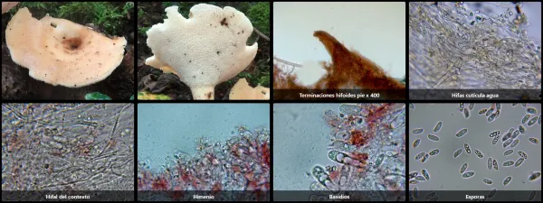 Microscopía de Polyporus tuberaster
