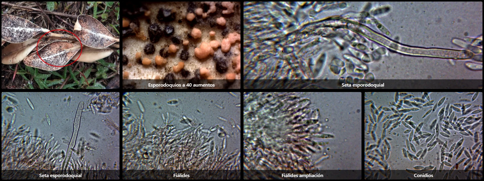 Microscopía de Pseudonectria buxi