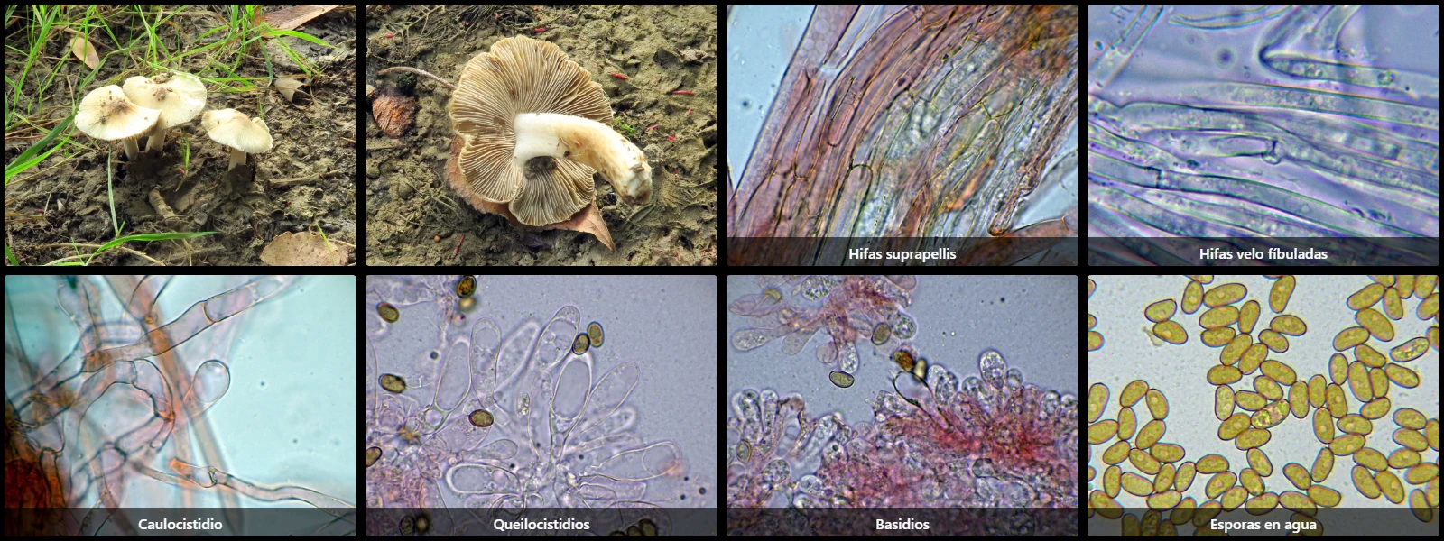 Microscopía de Pseudosperma obsoletum