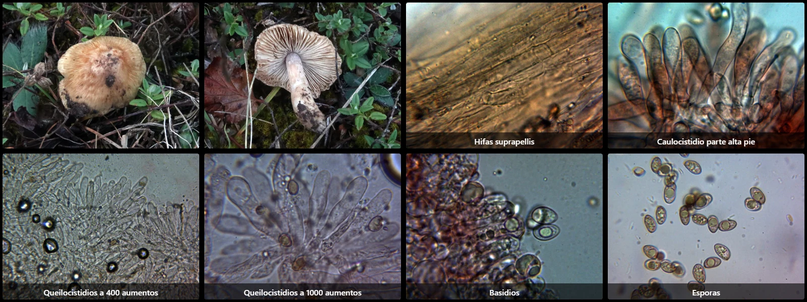Microscopía de Pseudosperma squamatum