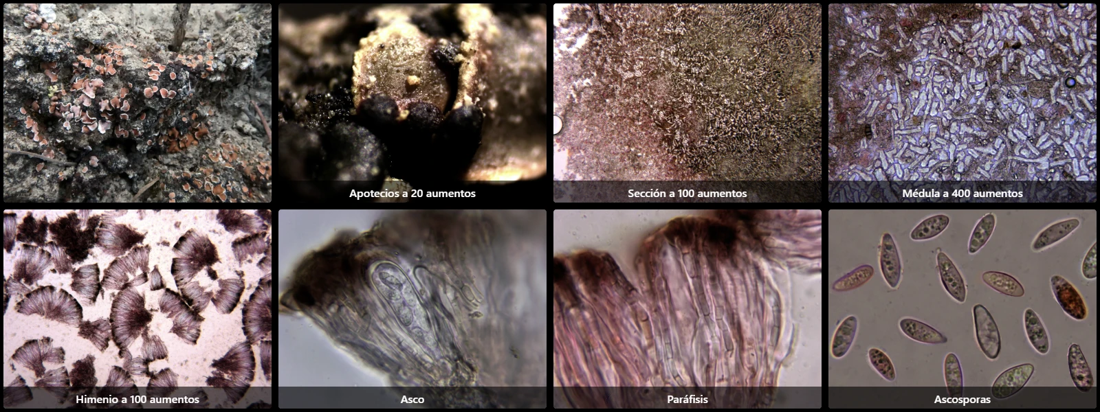 Microscopía de Psora decipiens