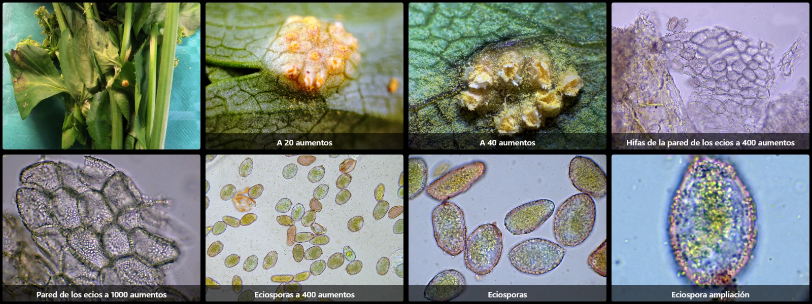Microscopía de Puccinia smyrnii