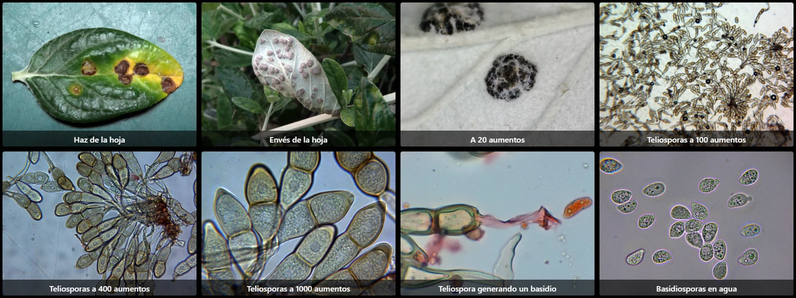 Microscopía de Puccinia teucrii
