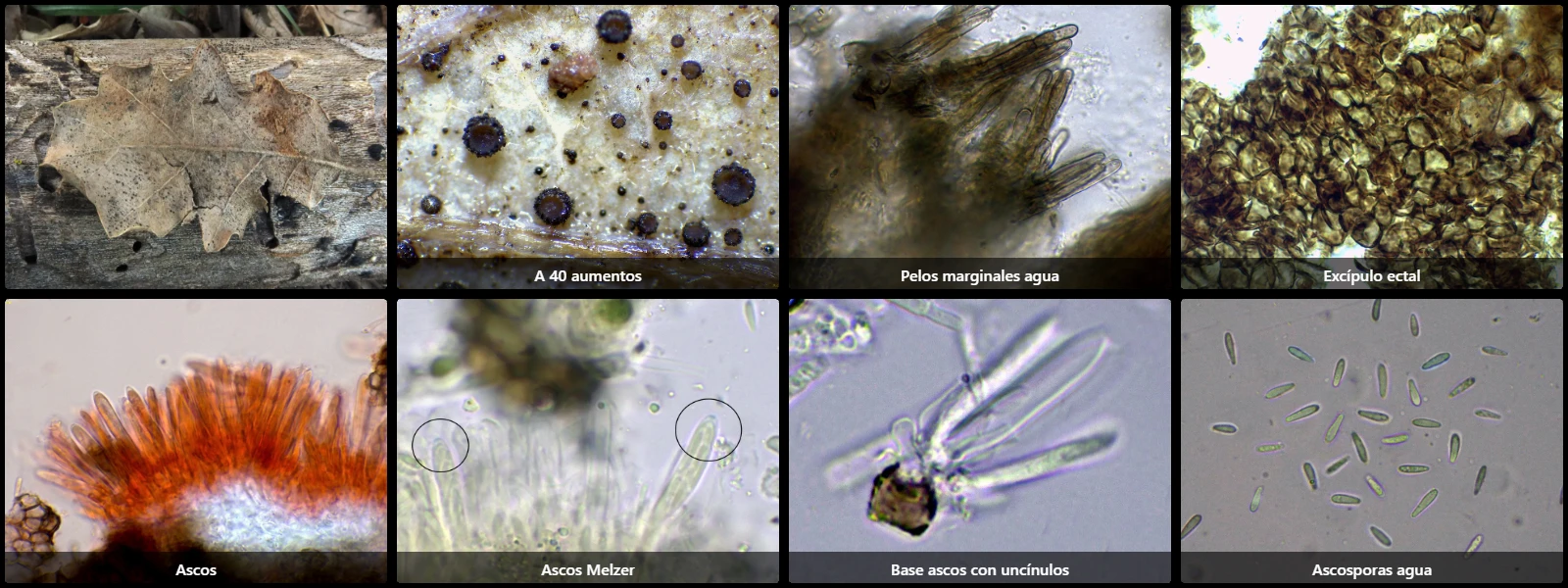 Microscopía de Pyrenopeziza nervicola