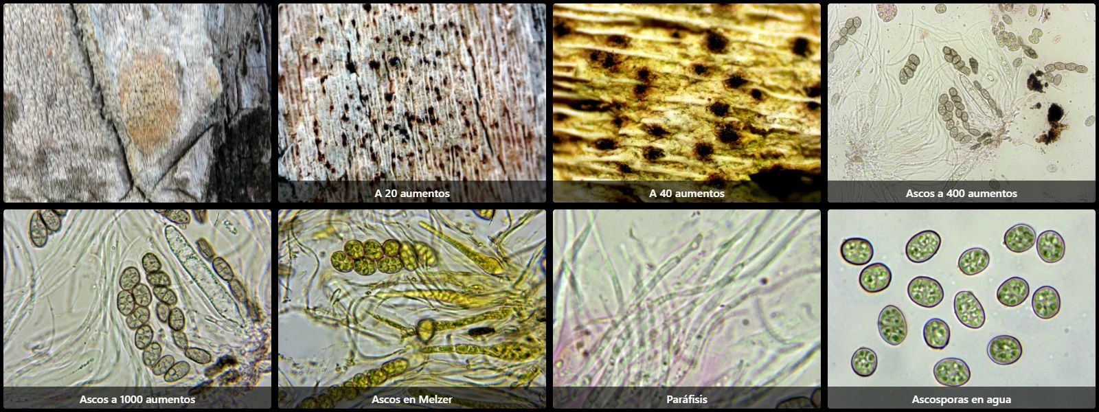 Microscopía de Pyrenula papilligera