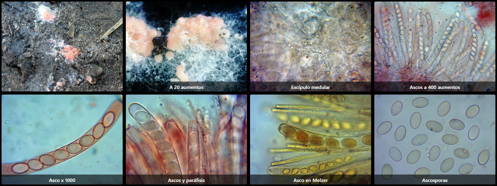 Microscopía de Pyronema domesticum