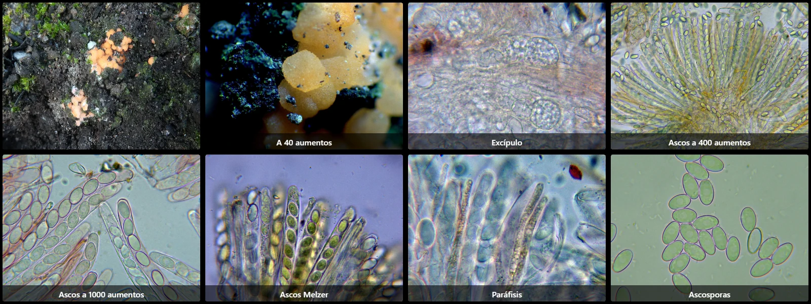 Microscopía de Pyronema omphalodes
