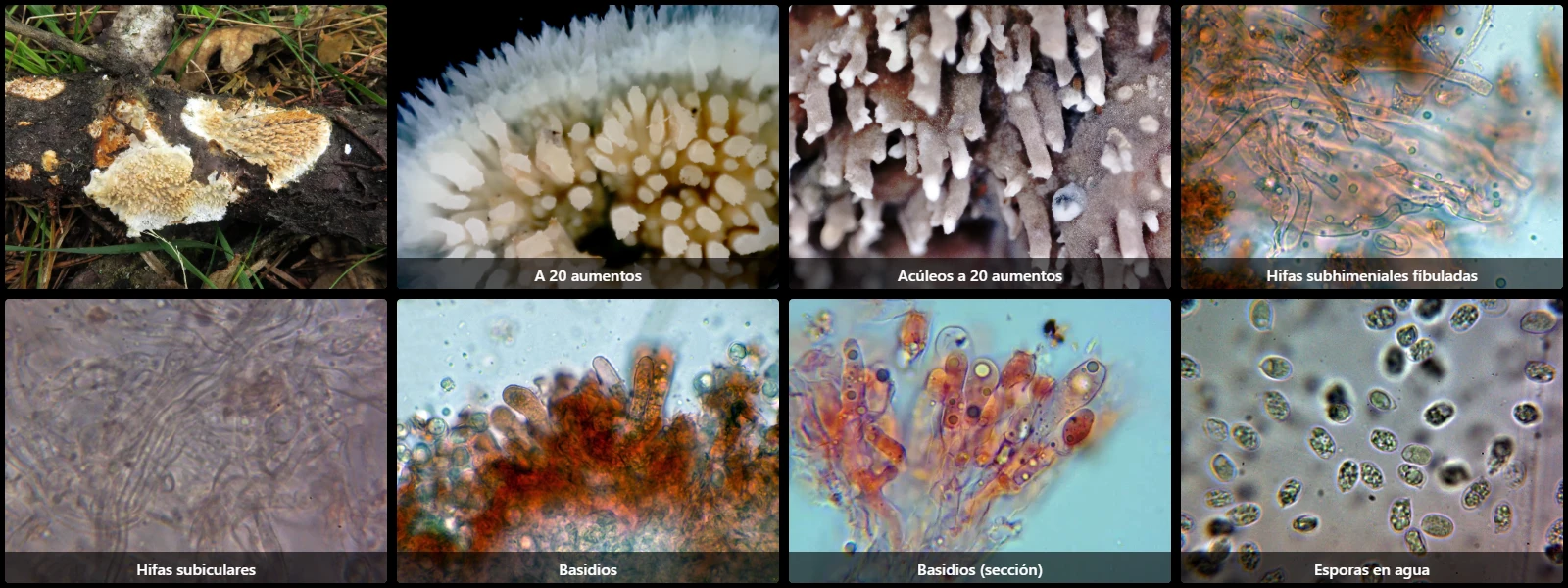 Microscopía de Radulomyces molaris