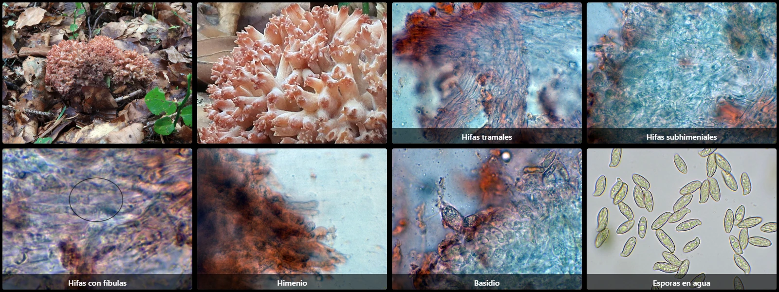 Microscopía de Ramaria botrytis