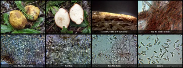 Microscopía de Rhizopogon luteolus
