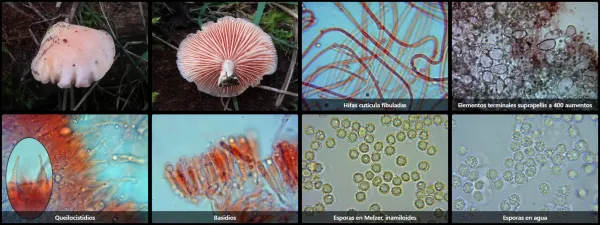 Microscopía de Rhodotus palmatus