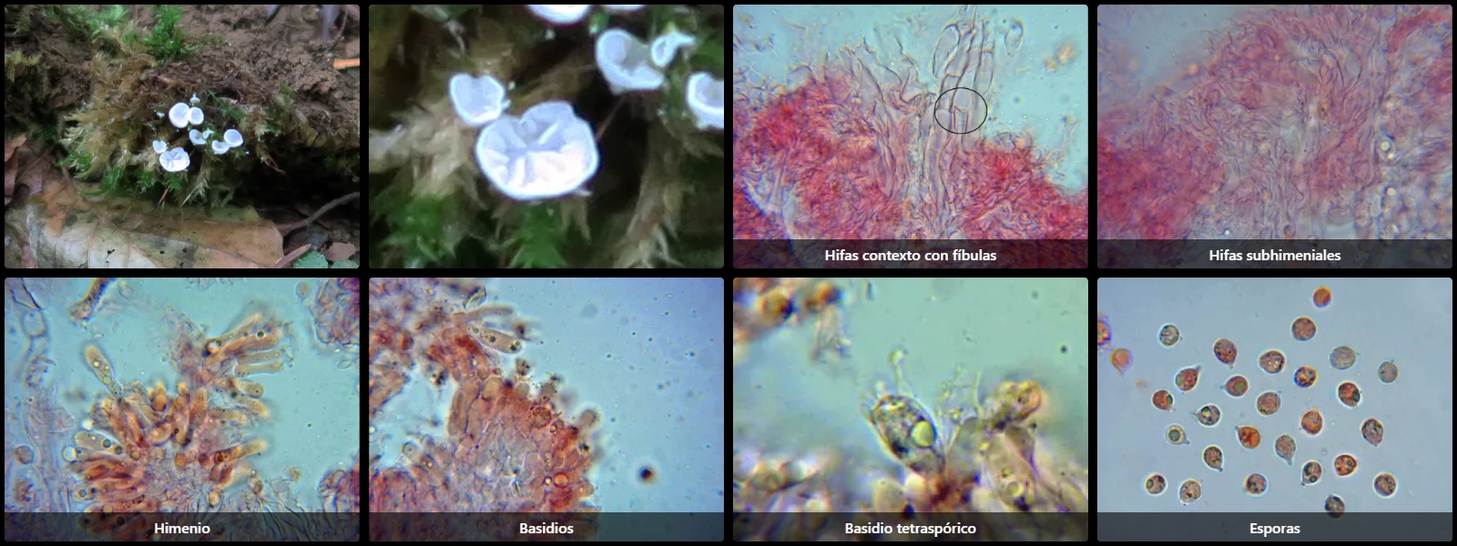 Microscopía de Rimbachia bryophila