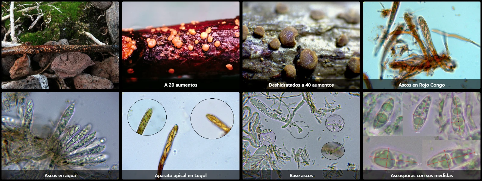 Microscopía de Rodwayella sessilis