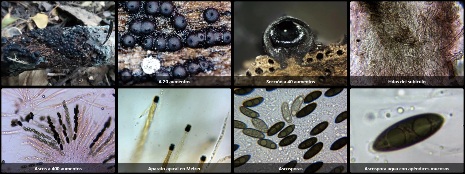 Microscopía de Rosellinia aquila