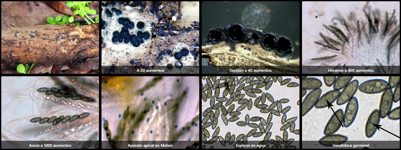 Microscopía de Rosellinia hyalospora