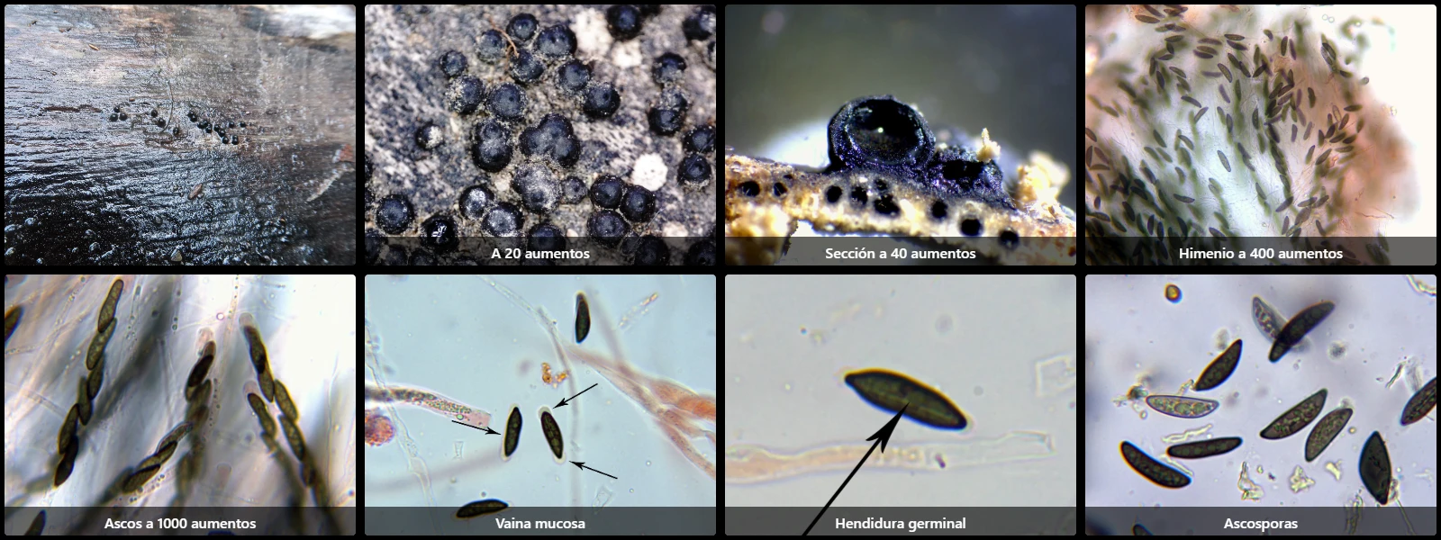 Microscopía de Rosellinia mammiformis
