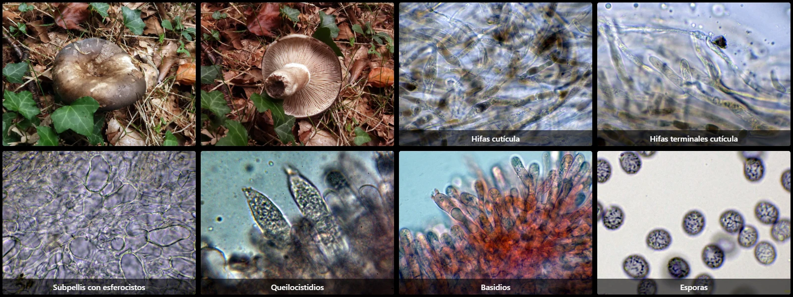 Microscopía de Russula anthracina