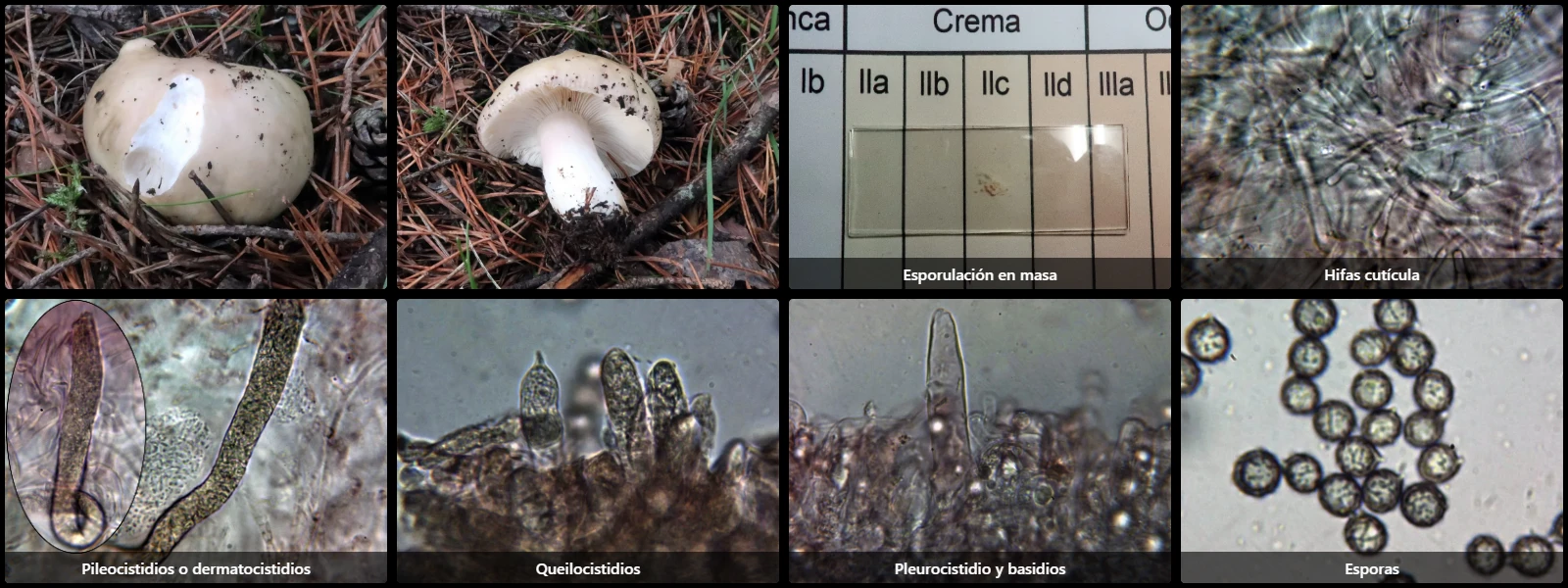 Microscopía de Russula citrinochlora