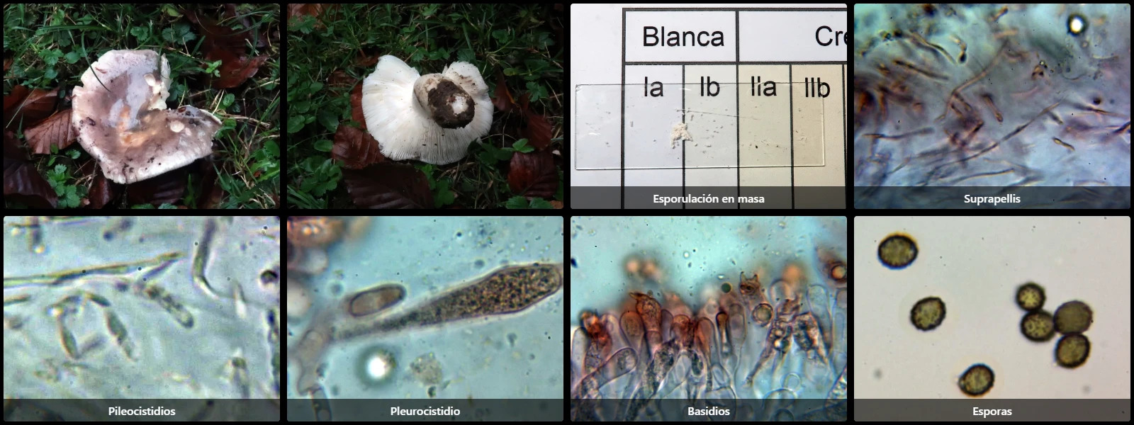 Microscopía de Russula cyanoxantha