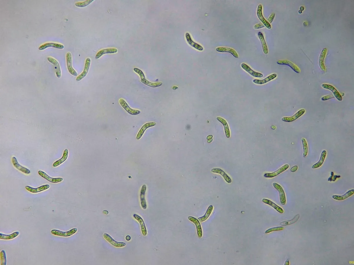 Microscopía de Ruzenia spermoides - Recorte