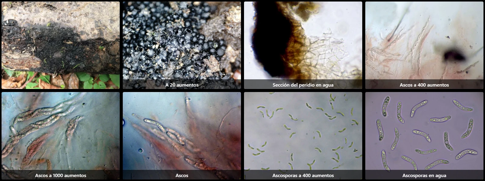 Microscopía de Ruzenia spermoides