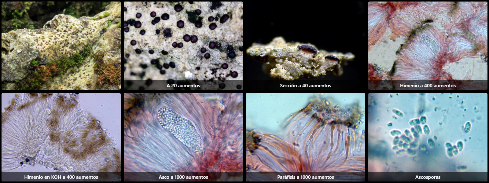 Microscopía de Sarcogyne regularis