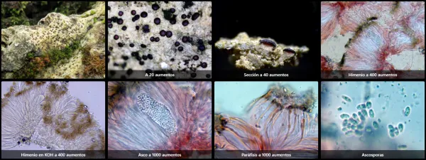 Microscopía de Sarcogyne regularis